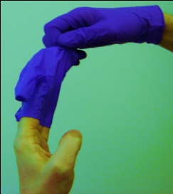 Glove Removal 2