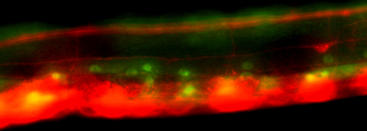 Photo representation of nematode C. elegans