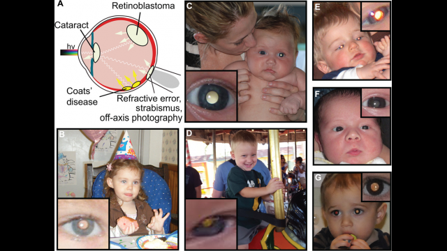 Newswise: Prototype Smartphone App Can Help Parents Detect Early Signs of Eye Disorders in Children, Study Finds