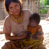 Bolivian Forager-Farmers Confront Changes in Lifestyle and Health