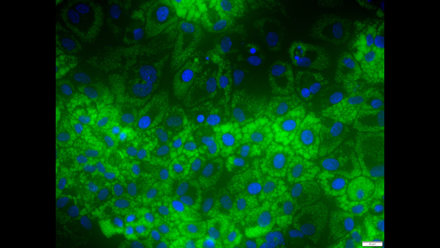 Full-Size Image: Liver cells (bl...